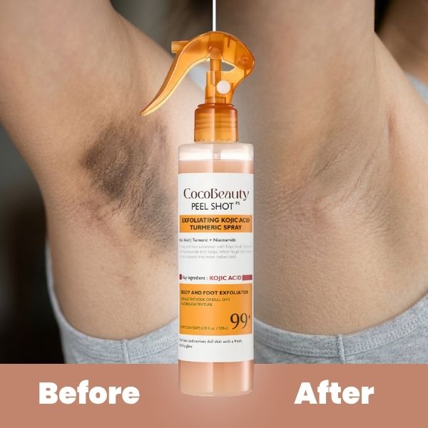 Lumièra – Body Peel Spray med kojinsyre & gurkemeje