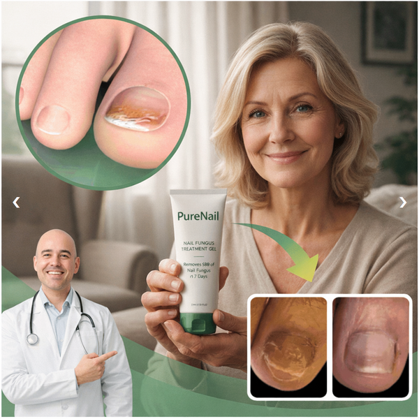 PureNail™ Neglebehandling | Fjerner 98% af Neglesvamp på 7 Dage – Klinisk Bevist