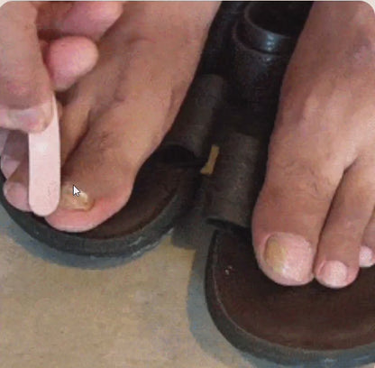 ClearNail Nagelbehandeling