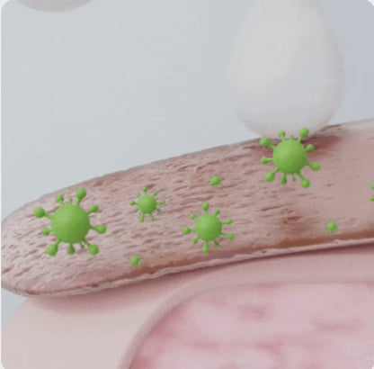 PureNail Nagelbehandeling Tar bort 98 % av nagelsvampen på 7 dagar!